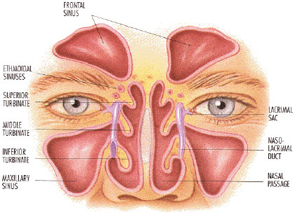 sinus infection medicine
